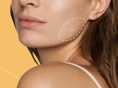https://burakolgun.com.tr/wp-content/uploads/2021/11/massater-botox-1-1-400x300.jpg